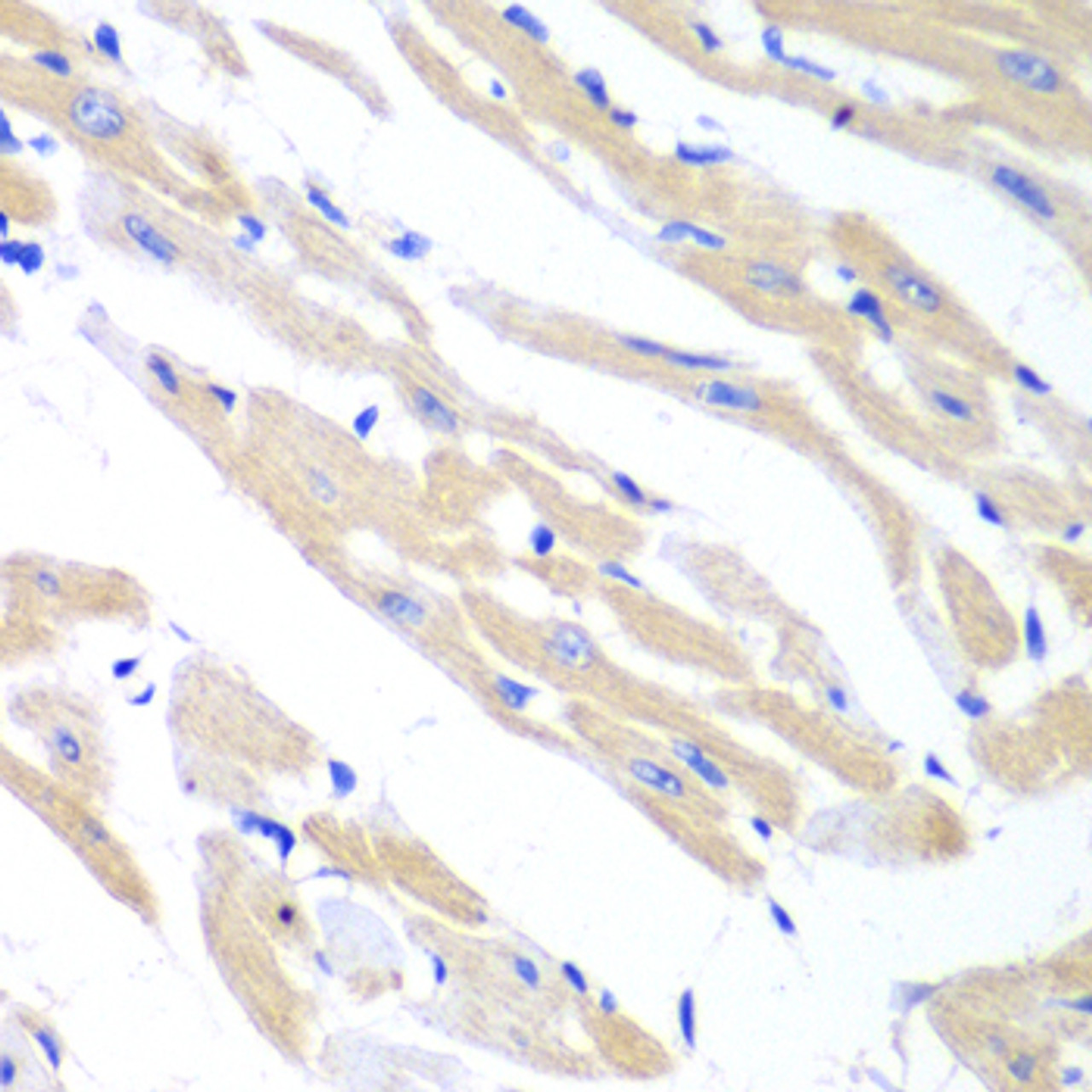 Immunohistochemistry of paraffin-embedded mouse heart using TRIM21 antibody (15-060) at dilution of 1:100 (40x lens) .