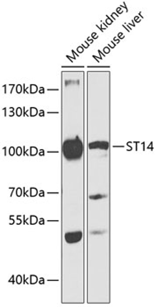 Western blot analysis of extracts of various cell lines, using ST14 antibody (15-062) at 1:1000 dilution.<br/>Secondary antibody: HRP Goat Anti-Rabbit IgG (H+L) at 1:10000 dilution.<br/>Lysates/proteins: 25ug per lane.<br/>Blocking buffer: 3% nonfat dry milk in TBST.<br/>Detection: ECL Basic Kit.<br/>Exposure time: 90s.