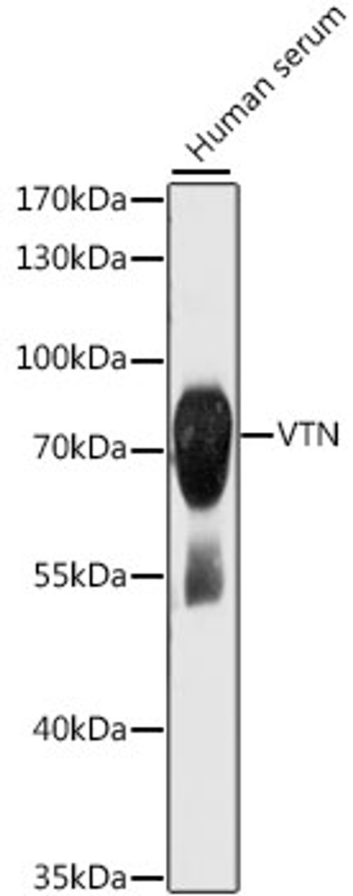 Western blot analysis of extracts of human serum, using VTN antibody (15-070) at 1:1000 dilution.<br/>Secondary antibody: HRP Goat Anti-Rabbit IgG (H+L) at 1:10000 dilution.<br/>Lysates/proteins: 25ug per lane.<br/>Blocking buffer: 3% nonfat dry milk in TBST.<br/>Detection: ECL Basic Kit.<br/>Exposure time: 1s.