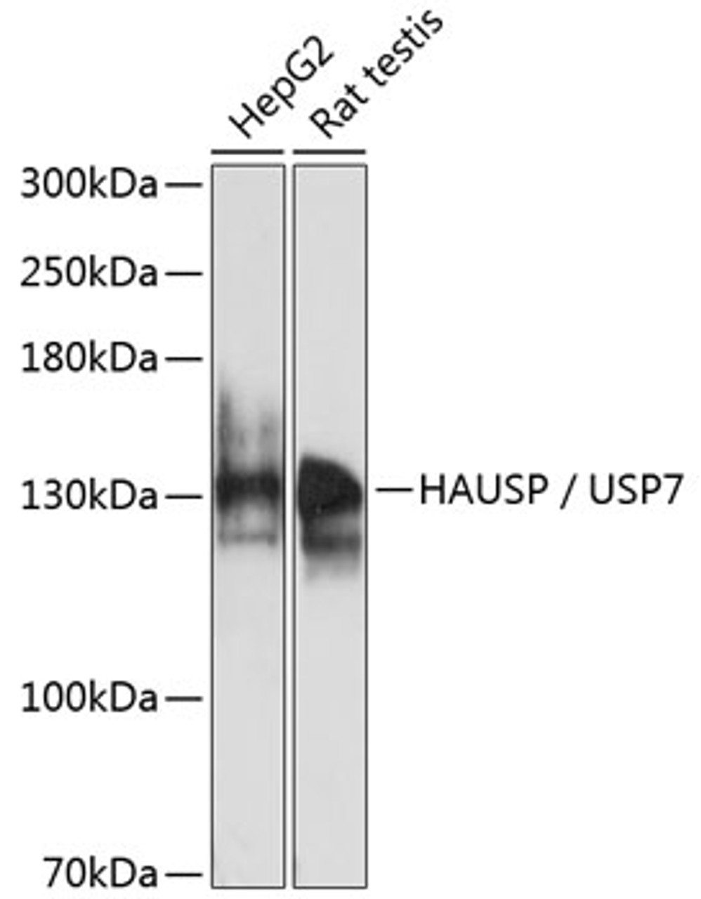 Western blot analysis of extracts of various cell lines, using HAUSP / USP7 antibody (15-072) at 1:1000 dilution.<br/>Secondary antibody: HRP Goat Anti-Rabbit IgG (H+L) at 1:10000 dilution.<br/>Lysates/proteins: 25ug per lane.<br/>Blocking buffer: 3% nonfat dry milk in TBST.<br/>Detection: ECL Basic Kit.<br/>Exposure time: 10s.