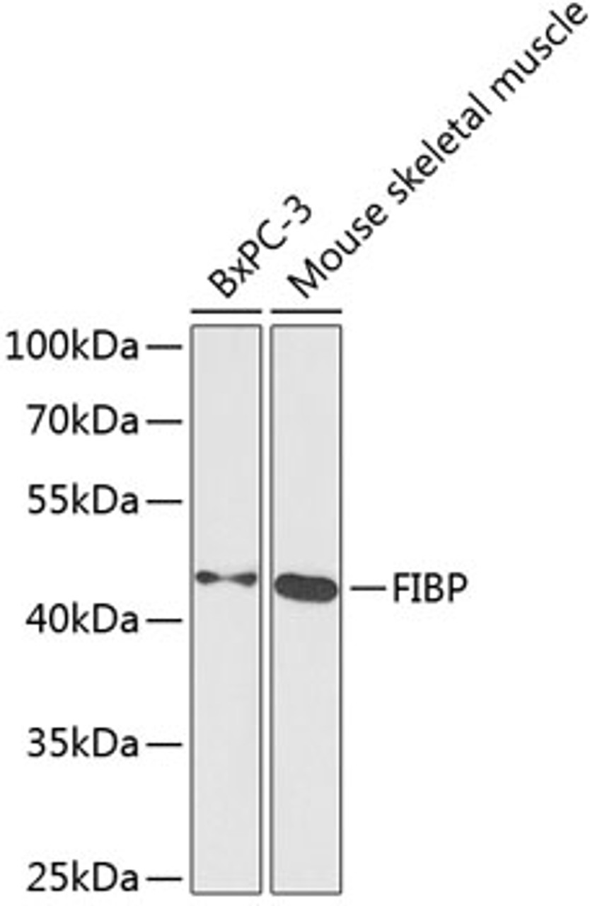 Western blot analysis of extracts of various cell lines, using FIBP antibody (15-076) at 1:1000 dilution.<br/>Secondary antibody: HRP Goat Anti-Rabbit IgG (H+L) at 1:10000 dilution.<br/>Lysates/proteins: 25ug per lane.<br/>Blocking buffer: 3% nonfat dry milk in TBST.<br/>Detection: ECL Basic Kit.<br/>Exposure time: 90s.