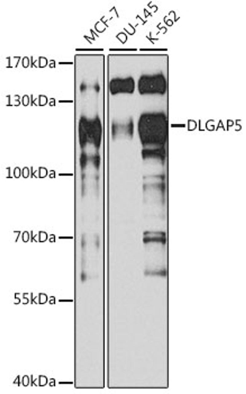 Western blot analysis of extracts of various cell lines, using DLGAP5 antibody (15-079) at 1:1000 dilution.<br/>Secondary antibody: HRP Goat Anti-Mouse IgG (H+L) (AS003) at 1:10000 dilution.<br/>Lysates/proteins: 25ug per lane.<br/>Blocking buffer: 3% nonfat dry milk in TBST.<br/>Detection: ECL Basic Kit.<br/>Exposure time: 90s.