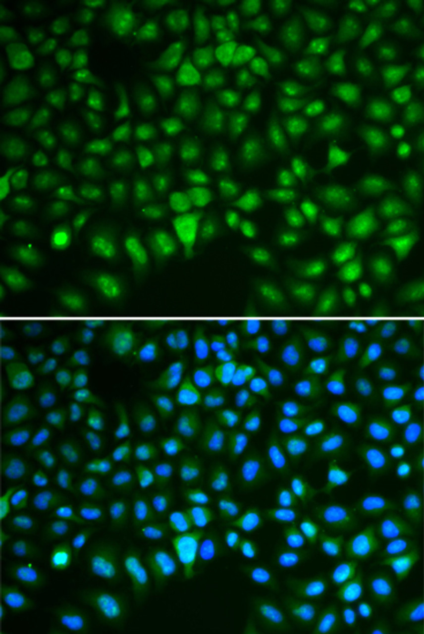 Immunofluorescence analysis of HeLa cells using DLGAP5 antibody (15-079) . Blue: DAPI for nuclear staining.