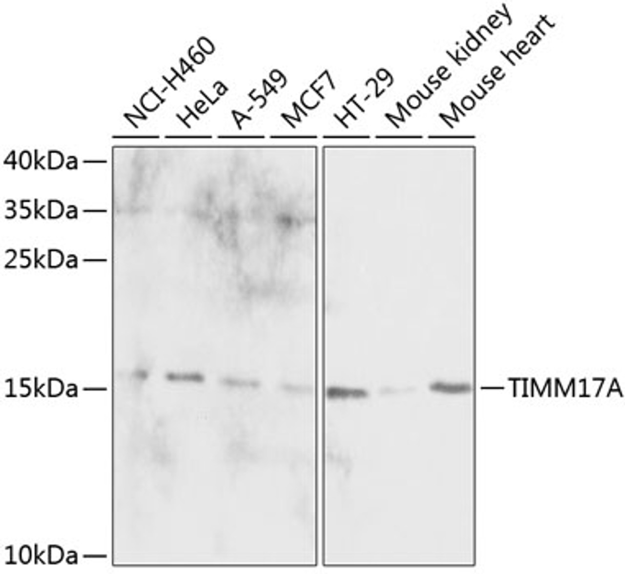 Western blot analysis of extracts of various cell lines, using TIMM17A antibody (15-082) at 1:1000 dilution.<br/>Secondary antibody: HRP Goat Anti-Rabbit IgG (H+L) at 1:10000 dilution.<br/>Lysates/proteins: 25ug per lane.<br/>Blocking buffer: 3% nonfat dry milk in TBST.<br/>Detection: ECL Basic Kit.<br/>Exposure time: 30s.