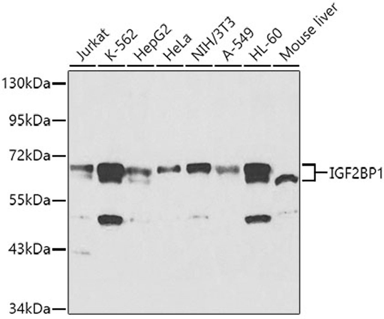 Western blot analysis of extracts of various cell lines, using IGF2BP1 antibody (15-085) at 1:1000 dilution.<br/>Secondary antibody: HRP Goat Anti-Rabbit IgG (H+L) at 1:10000 dilution.<br/>Lysates/proteins: 25ug per lane.<br/>Blocking buffer: 3% nonfat dry milk in TBST.