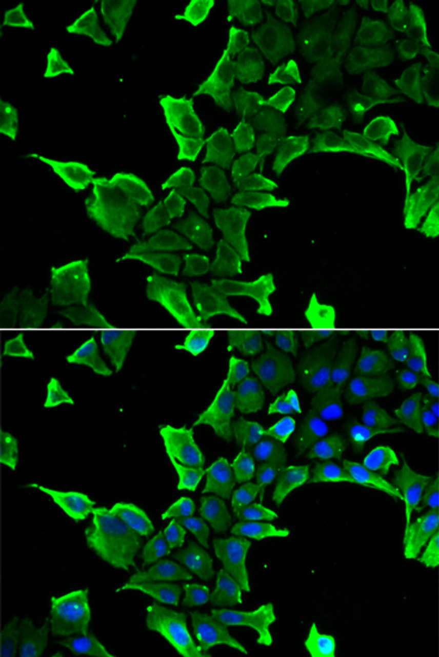 Immunofluorescence analysis of A549 cells using NCS1 antibody (15-089) . Blue: DAPI for nuclear staining.