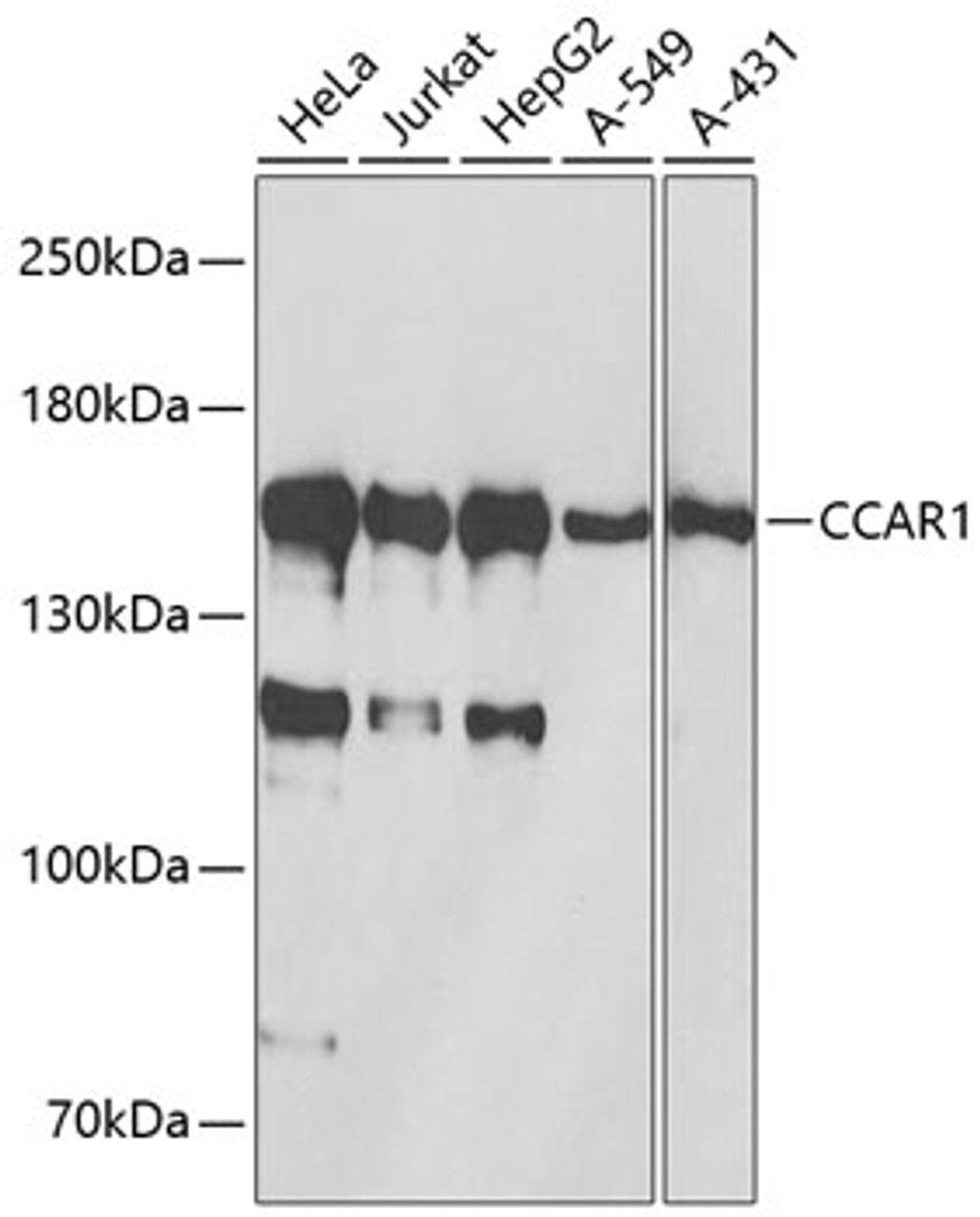 Western blot analysis of extracts of various cell lines, using CCAR1 antibody (15-094) at 1:1000 dilution._Secondary antibody: HRP Goat Anti-Rabbit IgG (H+L) at 1:10000 dilution._Lysates/proteins: 25ug per lane._Blocking buffer: 3% nonfat dry milk in TBST._Detection: ECL Basic Kit._Exposure time: 5s.