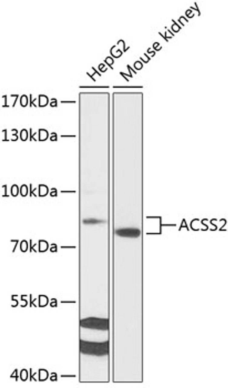 Western blot analysis of extracts of various cell lines, using ACSS2 antibody (15-095) at 1:1000 dilution.<br/>Secondary antibody: HRP Goat Anti-Rabbit IgG (H+L) at 1:10000 dilution.<br/>Lysates/proteins: 25ug per lane.<br/>Blocking buffer: 3% nonfat dry milk in TBST.<br/>Detection: ECL Basic Kit.<br/>Exposure time: 90s.