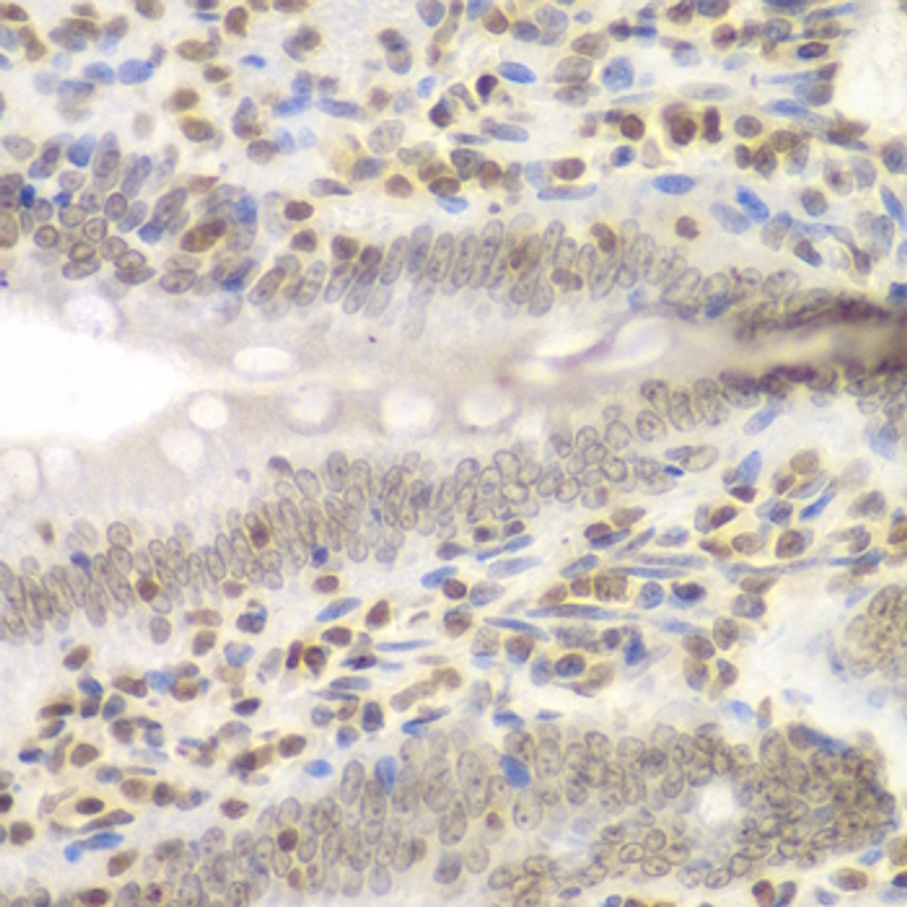 Immunohistochemistry of paraffin-embedded rat Intestine using UHRF2 antibody (15-099) at dilution of 1:200 (40x lens) .