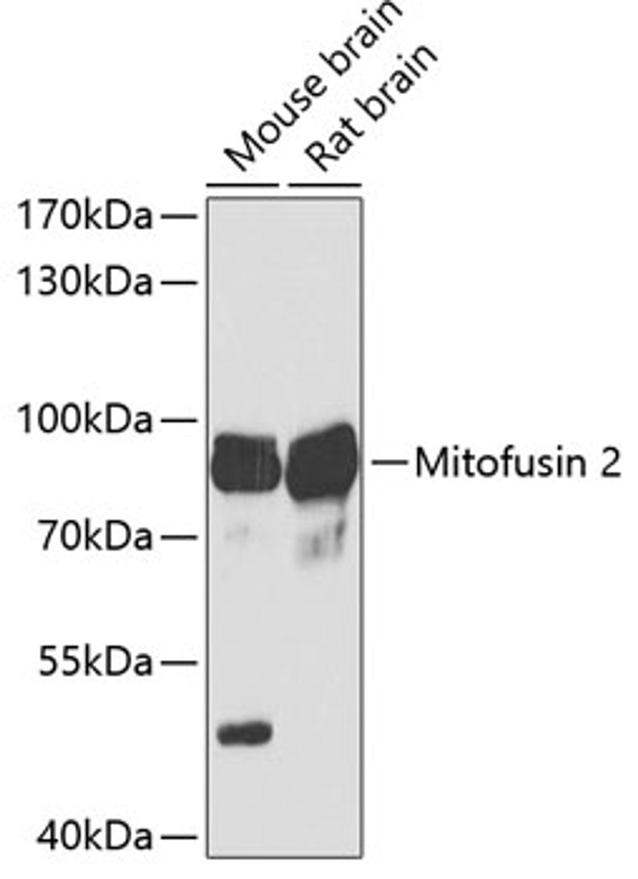 Western blot analysis of extracts of various cell lines, using Mitofusin 2 Antibody (15-100) at 1:1000 dilution.<br/>Secondary antibody: HRP Goat Anti-Rabbit IgG (H+L) at 1:10000 dilution.<br/>Lysates/proteins: 25ug per lane.<br/>Blocking buffer: 3% nonfat dry milk in TBST.<br/>Detection: ECL Basic Kit.<br/>Exposure time: 30s.