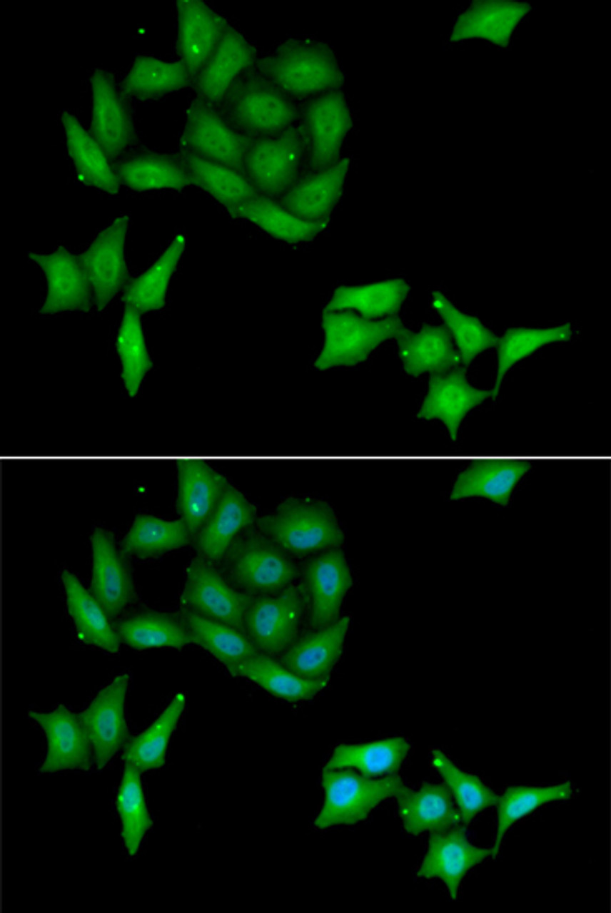 Immunofluorescence analysis of HeLa cells using CCNC antibody (15-103) . Blue: DAPI for nuclear staining.