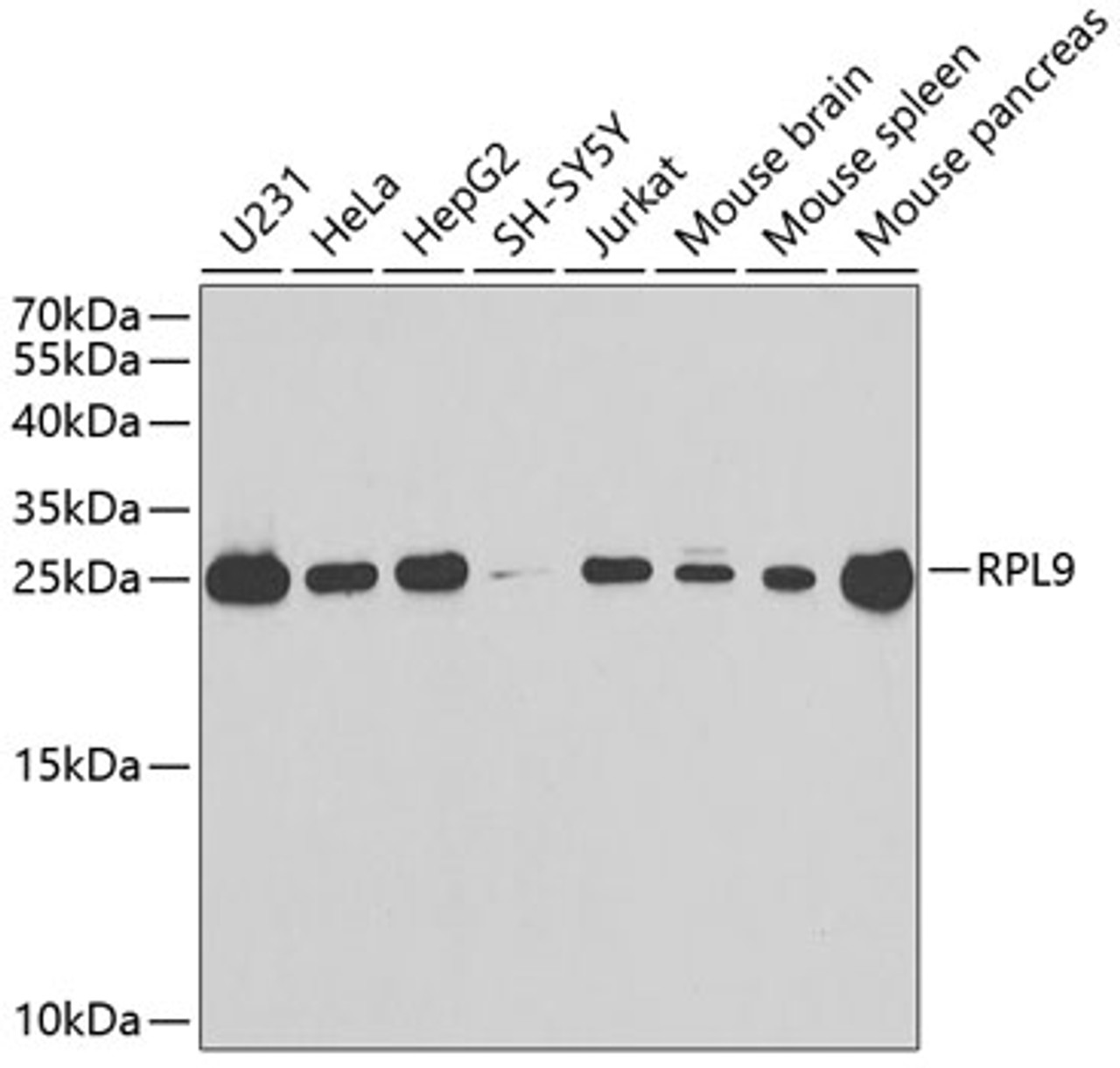 Western blot analysis of extracts of various cell lines, using RPL9 antibody (15-113) at 1:1000 dilution.<br/>Secondary antibody: HRP Goat Anti-Rabbit IgG (H+L) at 1:10000 dilution.<br/>Lysates/proteins: 25ug per lane.<br/>Blocking buffer: 3% nonfat dry milk in TBST.<br/>Detection: ECL Basic Kit.<br/>Exposure time: 90s.