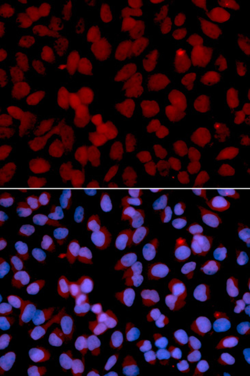 Immunofluorescence analysis of U2OS cells using TNFAIP3 antibody (15-118) . Blue: DAPI for nuclear staining.