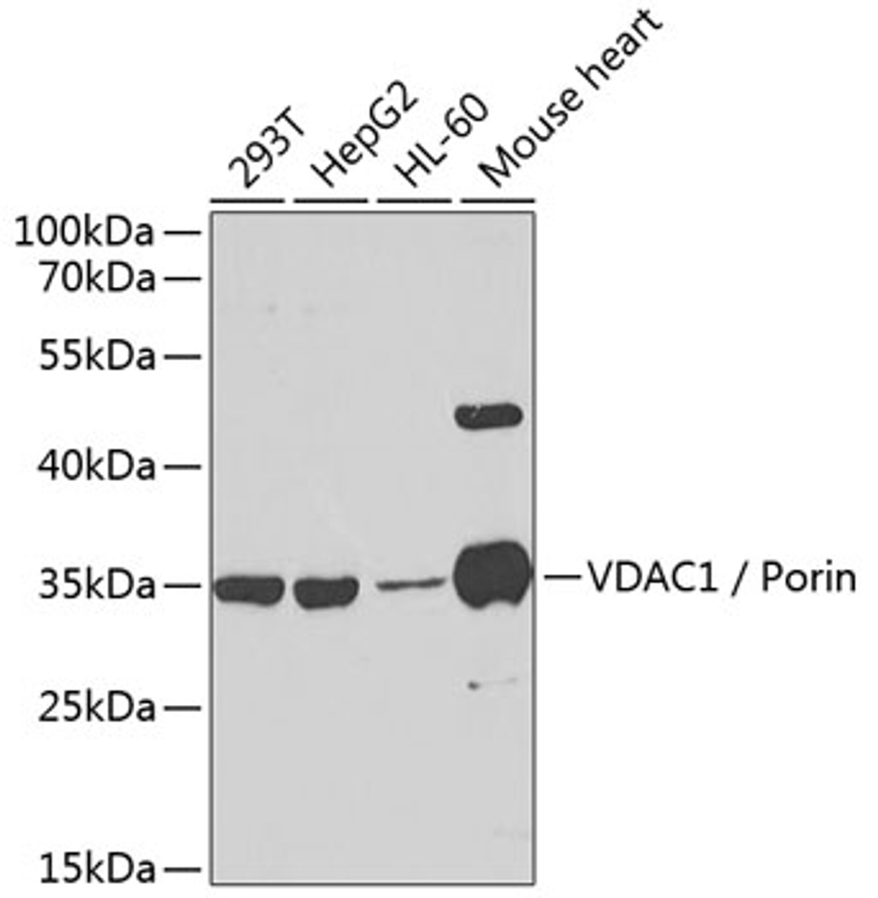 Western blot analysis of extracts of various cell lines, using VDAC1 / Porin antibody (15-119) at 1:1000 dilution.<br/>Secondary antibody: HRP Goat Anti-Rabbit IgG (H+L) at 1:10000 dilution.<br/>Lysates/proteins: 25ug per lane.<br/>Blocking buffer: 3% nonfat dry milk in TBST.