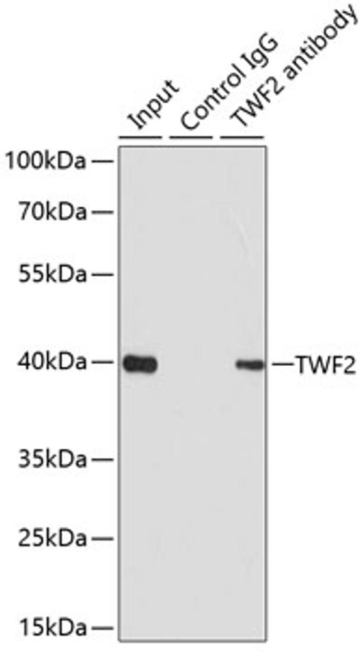 Immunoprecipitation analysis of 200ug extracts of 293T cells using 1ug TWF2 antibody (15-123) . Western blot was performed from the immunoprecipitate using TWF2 antibody (15-123) at a dilition of 1:1000.