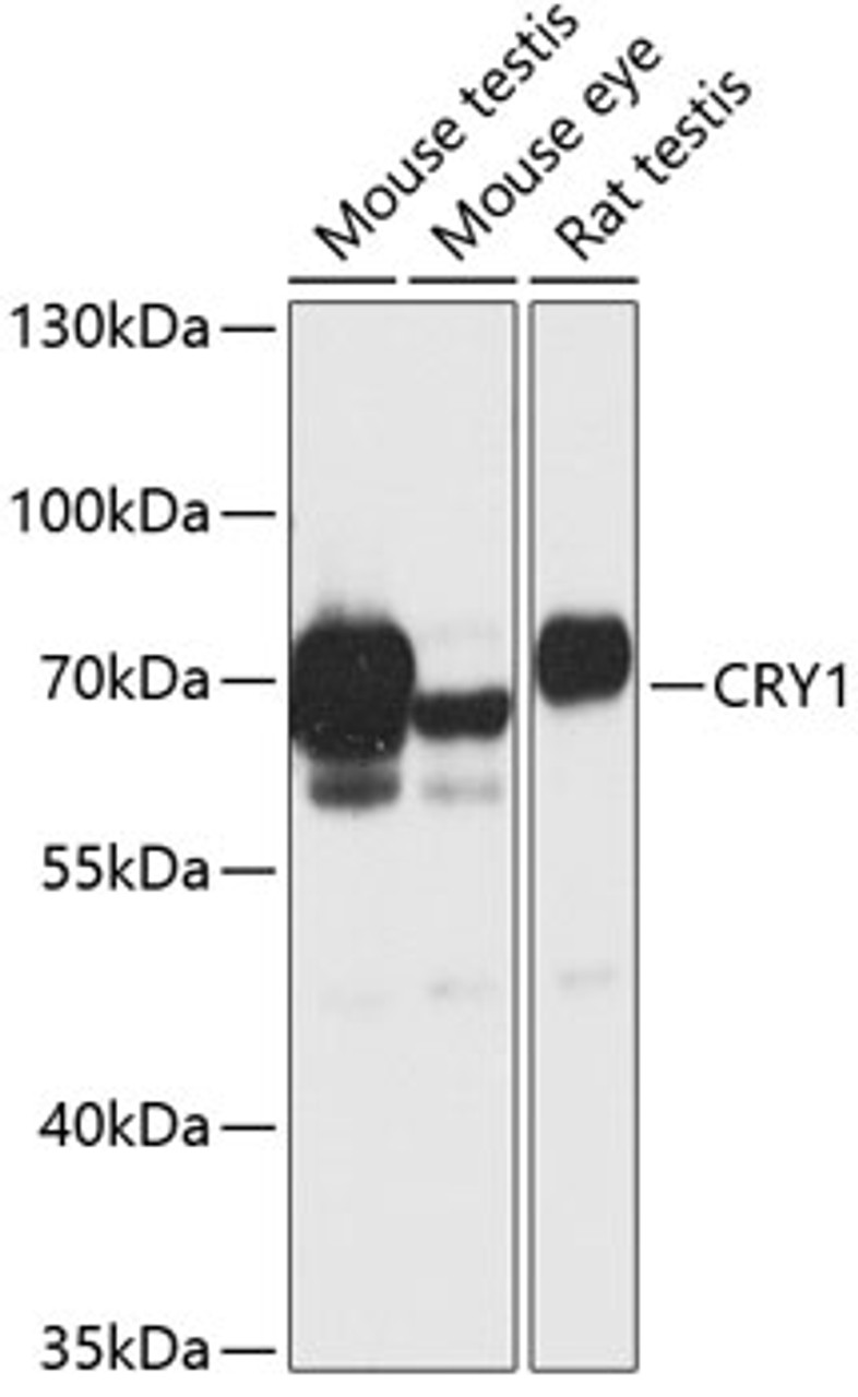Western blot analysis of extracts of various cell lines, using CRY1 antibody (15-131) at 1:1000 dilution.<br/>Secondary antibody: HRP Goat Anti-Rabbit IgG (H+L) at 1:10000 dilution.<br/>Lysates/proteins: 25ug per lane.<br/>Blocking buffer: 3% nonfat dry milk in TBST.<br/>Detection: ECL Basic Kit.<br/>Exposure time: 30s.