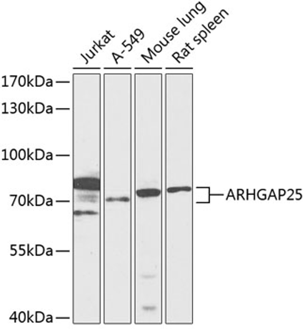 Western blot analysis of extracts of various cell lines, using ARHGAP25 antibody (15-133) at 1:1000 dilution.<br/>Secondary antibody: HRP Goat Anti-Rabbit IgG (H+L) at 1:10000 dilution.<br/>Lysates/proteins: 25ug per lane.<br/>Blocking buffer: 3% nonfat dry milk in TBST.<br/>Detection: ECL Enhanced Kit.<br/>Exposure time: 30s.