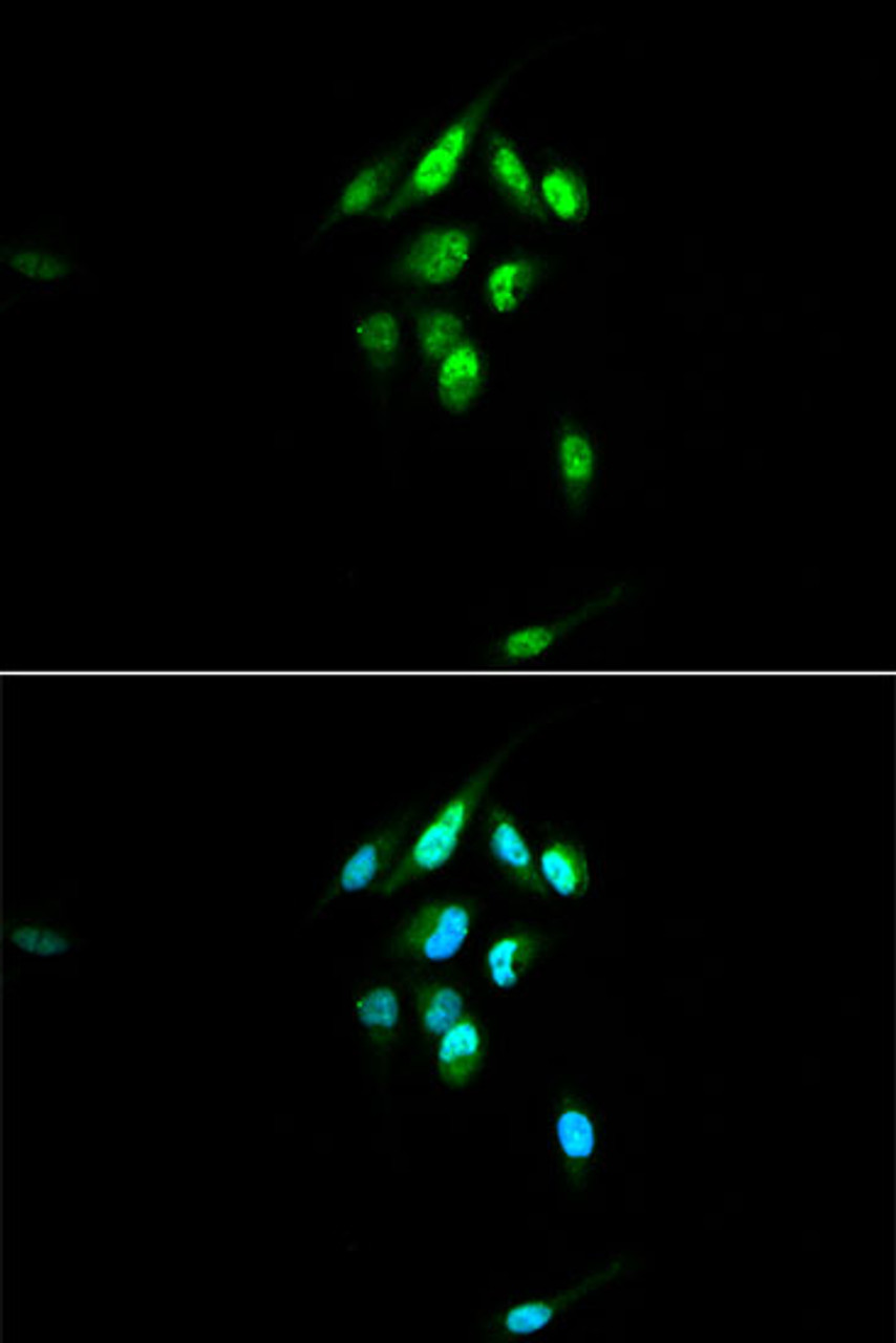Immunofluorescence analysis of U2OS cells using NR3C1 antibody (15-135) at dilution of 1:100. Blue: DAPI for nuclear staining.