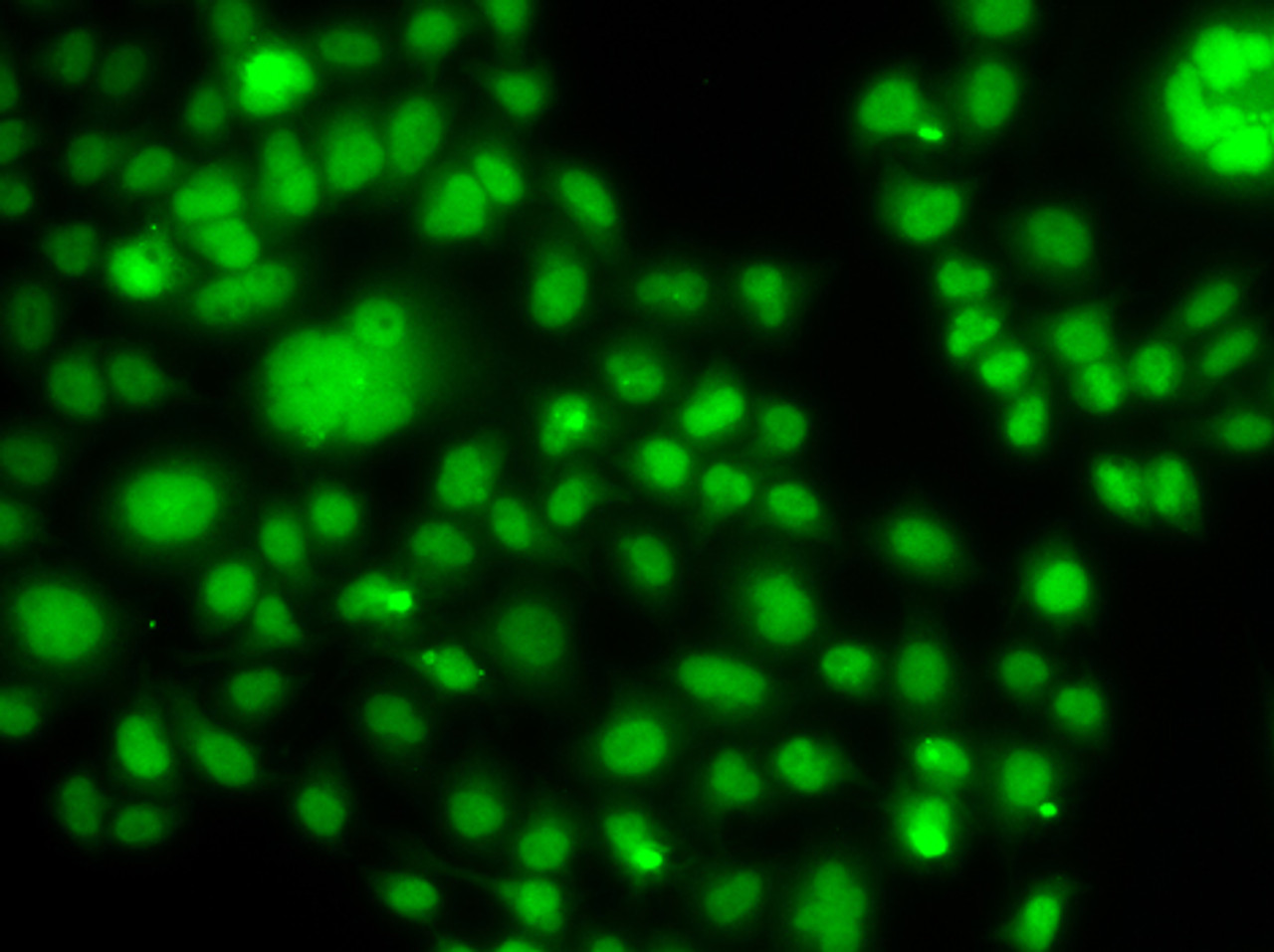 Immunofluorescence analysis of MCF-7 cells using SOX14 antibody (15-141) .