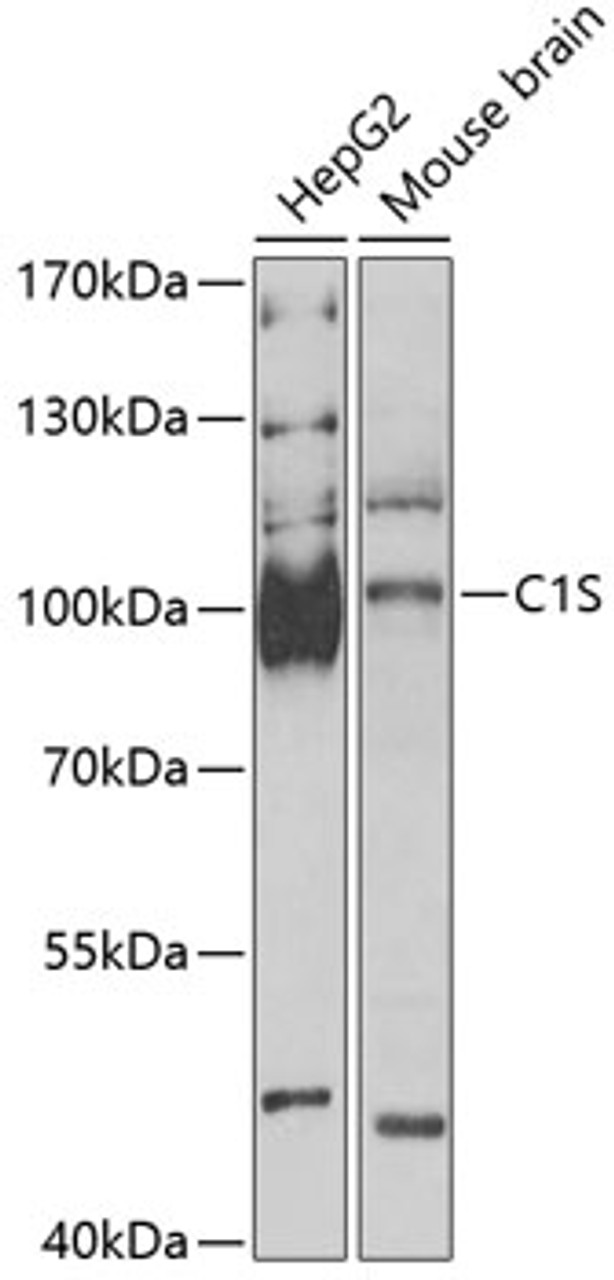 Western blot analysis of extracts of various cell lines, using C1S antibody (15-142) at 1:1000 dilution.<br/>Secondary antibody: HRP Goat Anti-Rabbit IgG (H+L) at 1:10000 dilution.<br/>Lysates/proteins: 25ug per lane.<br/>Blocking buffer: 3% nonfat dry milk in TBST.<br/>Detection: ECL Basic Kit.<br/>Exposure time: 90s.