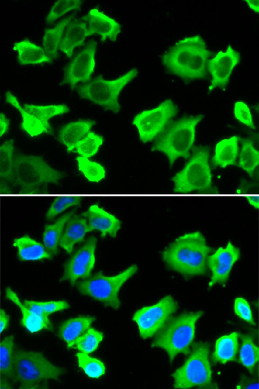 Immunofluorescence analysis of A549 cells using HSPB1 antibody (15-146) . Blue: DAPI for nuclear staining.