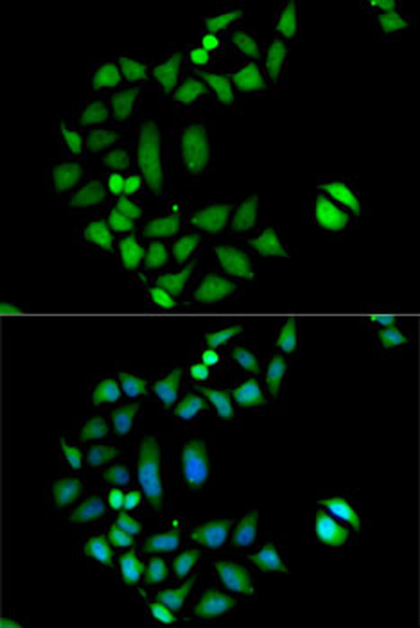 Immunofluorescence analysis of MCF7 cells using CLIC1 antibody (15-149) . Blue: DAPI for nuclear staining.