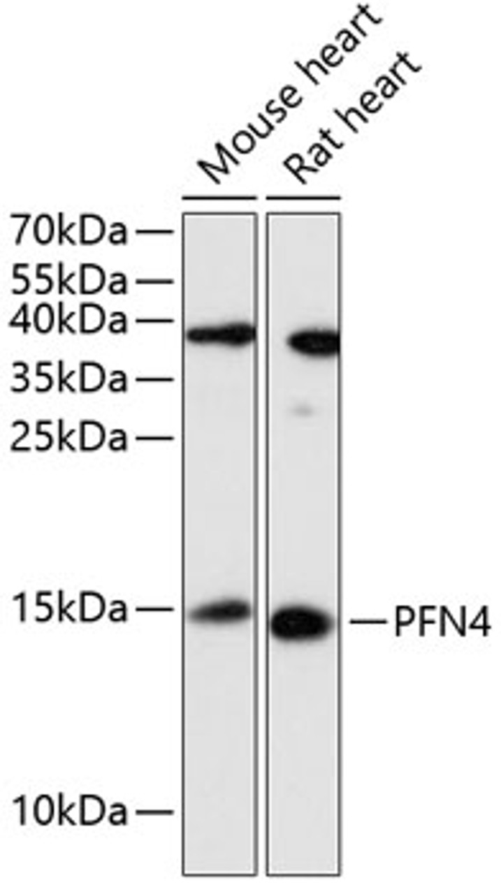 Western blot analysis of extracts of various cell lines, using PFN4 antibody (15-153) at 1:3000 dilution.<br/>Secondary antibody: HRP Goat Anti-Rabbit IgG (H+L) at 1:10000 dilution.<br/>Lysates/proteins: 25ug per lane.<br/>Blocking buffer: 3% nonfat dry milk in TBST.<br/>Detection: ECL Enhanced Kit.<br/>Exposure time: 5min.