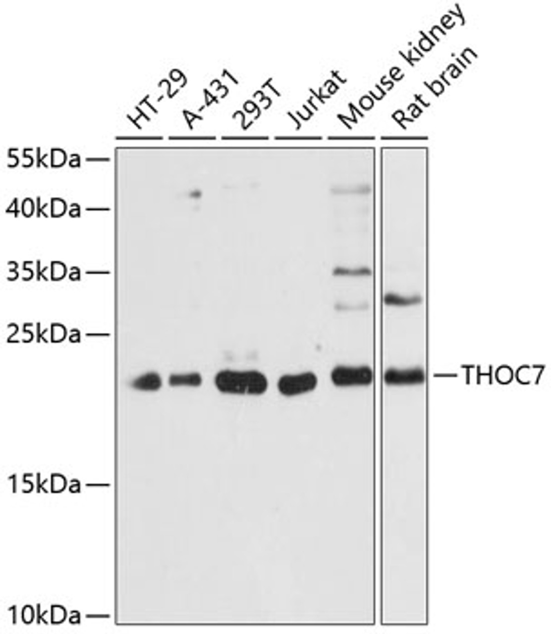 Western blot analysis of extracts of various cell lines, using THOC7 antibody (15-158) at 1:3000 dilution.<br/>Secondary antibody: HRP Goat Anti-Rabbit IgG (H+L) at 1:10000 dilution.<br/>Lysates/proteins: 25ug per lane.<br/>Blocking buffer: 3% nonfat dry milk in TBST.<br/>Detection: ECL Basic Kit.<br/>Exposure time: 60s.