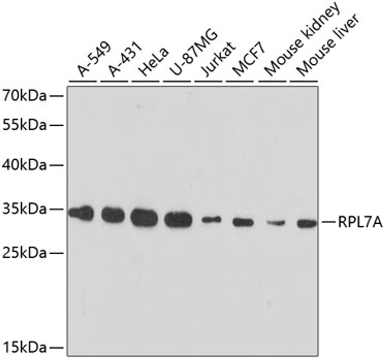 Western blot analysis of extracts of various cell lines, using RPL7A antibody (15-164) at 1:3000 dilution.<br/>Secondary antibody: HRP Goat Anti-Rabbit IgG (H+L) at 1:10000 dilution.<br/>Lysates/proteins: 25ug per lane.<br/>Blocking buffer: 3% nonfat dry milk in TBST.<br/>Detection: ECL Basic Kit.<br/>Exposure time: 90s.
