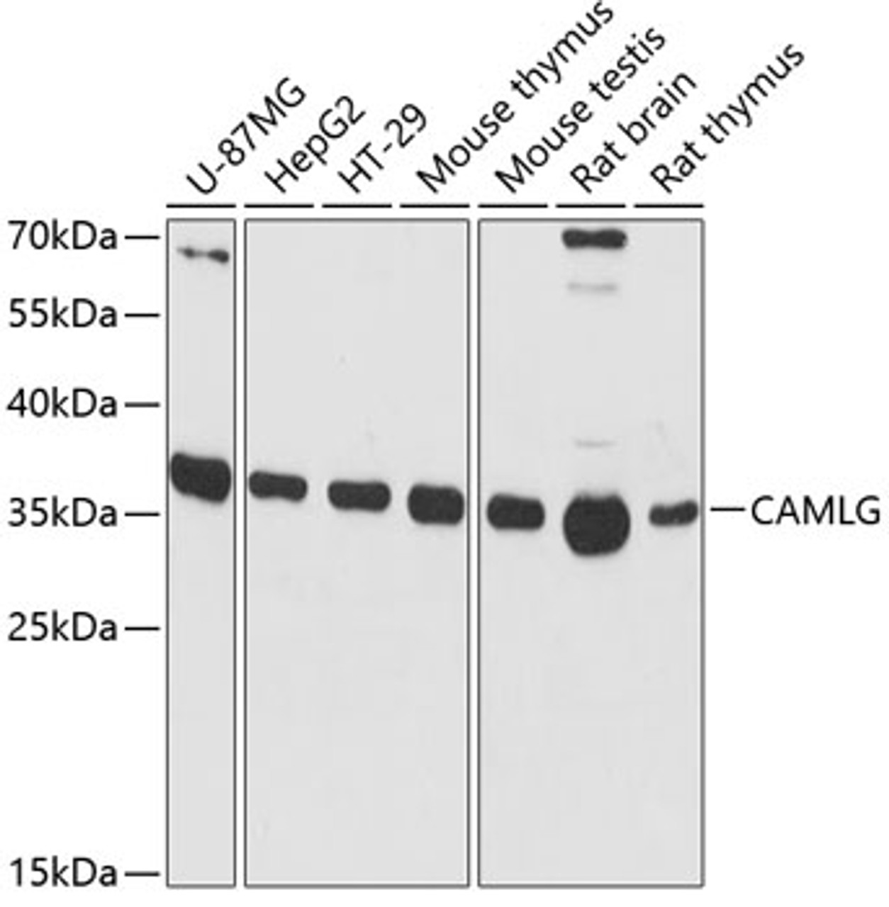 Western blot analysis of extracts of various cell lines, using CAMLG antibody (15-165) at 1:3000 dilution.<br/>Secondary antibody: HRP Goat Anti-Rabbit IgG (H+L) at 1:10000 dilution.<br/>Lysates/proteins: 25ug per lane.<br/>Blocking buffer: 3% nonfat dry milk in TBST.<br/>Detection: ECL Basic Kit.<br/>Exposure time: 90s.