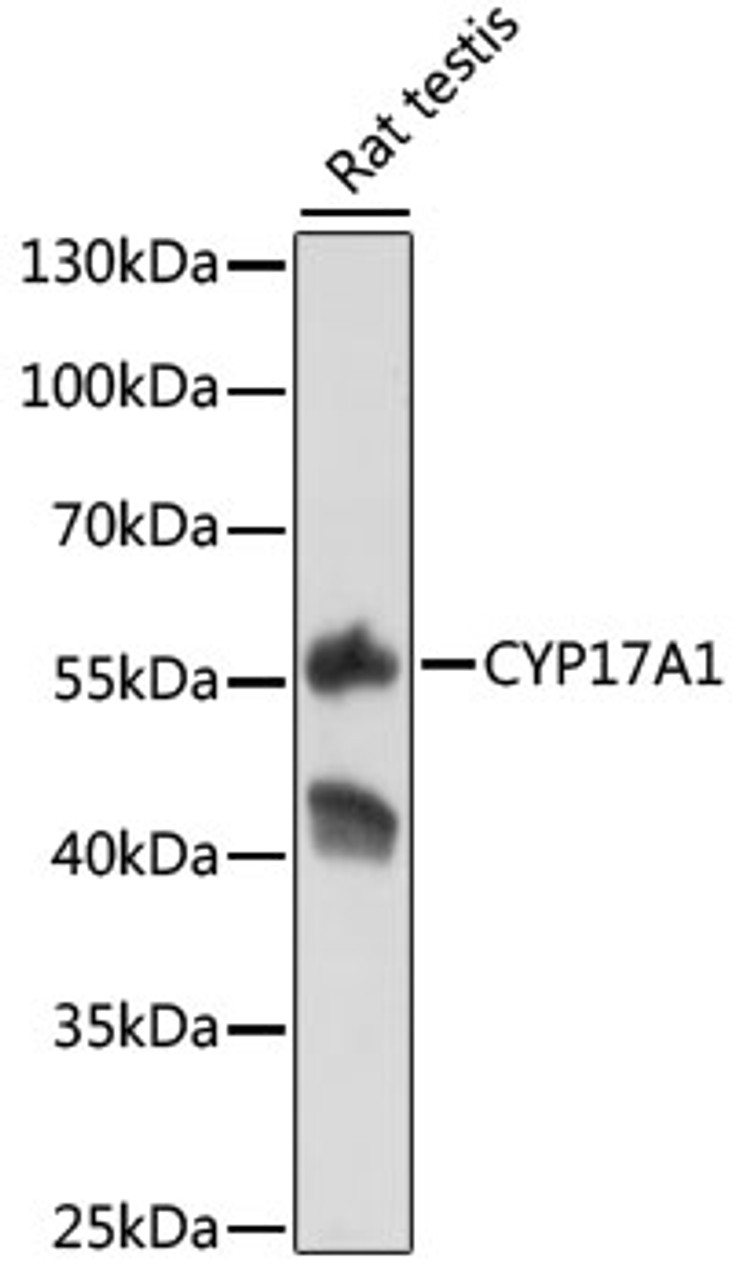 Western blot analysis of extracts of rat testis, using CYP17A1 antibody (15-168) at 1:500 dilution.<br/>Secondary antibody: HRP Goat Anti-Rabbit IgG (H+L) at 1:10000 dilution.<br/>Lysates/proteins: 25ug per lane.<br/>Blocking buffer: 3% nonfat dry milk in TBST.<br/>Detection: ECL Basic Kit.<br/>Exposure time: 10s.