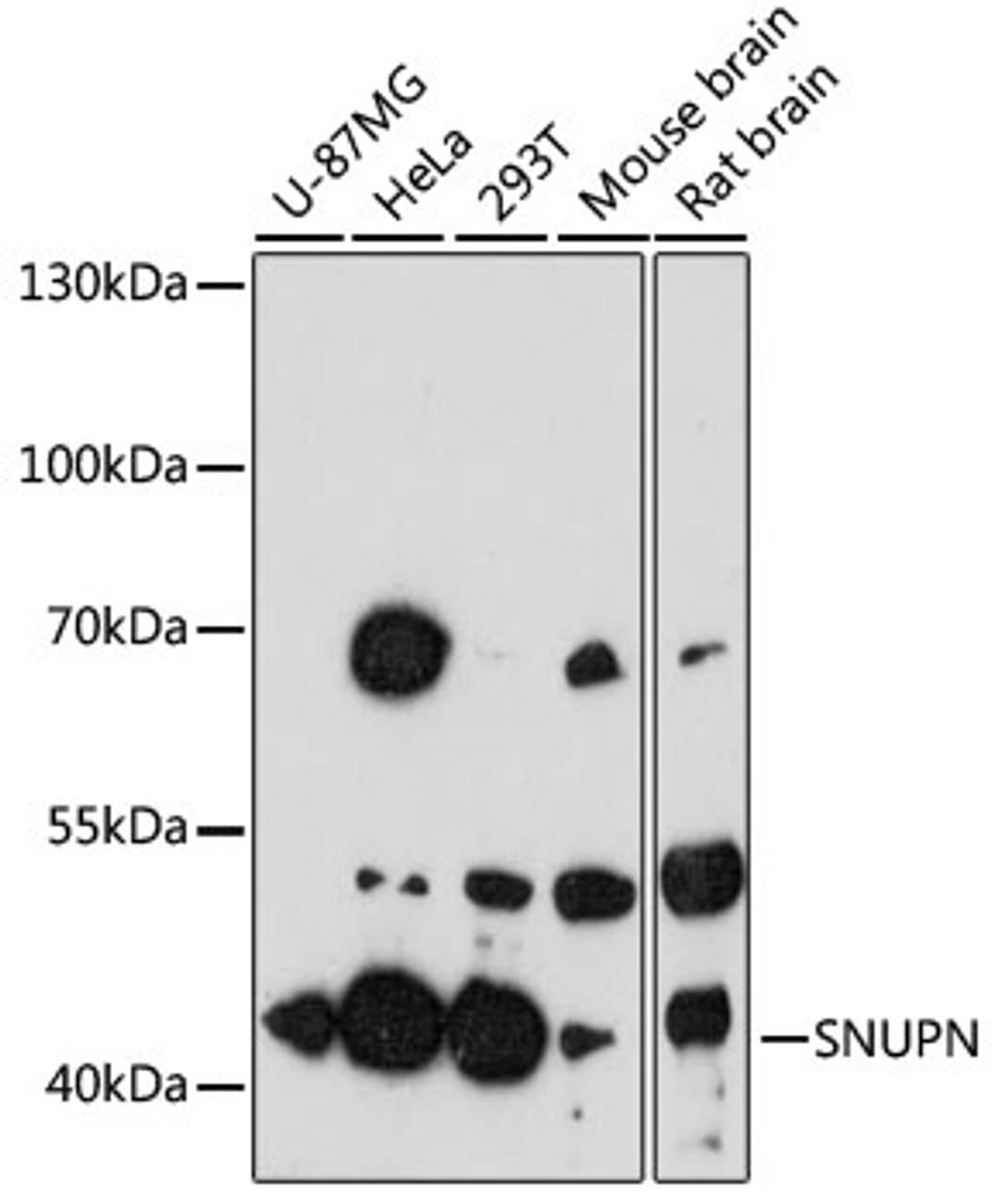 Western blot analysis of extracts of various cell lines, using SNUPN antibody (15-173) at 1:3000 dilution.<br/>Secondary antibody: HRP Goat Anti-Rabbit IgG (H+L) at 1:10000 dilution.<br/>Lysates/proteins: 25ug per lane.<br/>Blocking buffer: 3% nonfat dry milk in TBST.<br/>Detection: ECL Enhanced Kit.<br/>Exposure time: 90s.