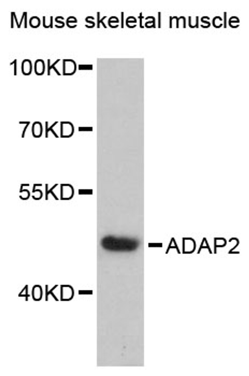 Western blot analysis of extracts of mouse skeletal muscle, using ADAP2 antibody (15-175) at 1:3000 dilution.<br/>Secondary antibody: HRP Goat Anti-Rabbit IgG (H+L) at 1:10000 dilution.<br/>Lysates/proteins: 25ug per lane.<br/>Blocking buffer: 3% nonfat dry milk in TBST.<br/>Detection: ECL Enhanced Kit.<br/>Exposure time: 90s.