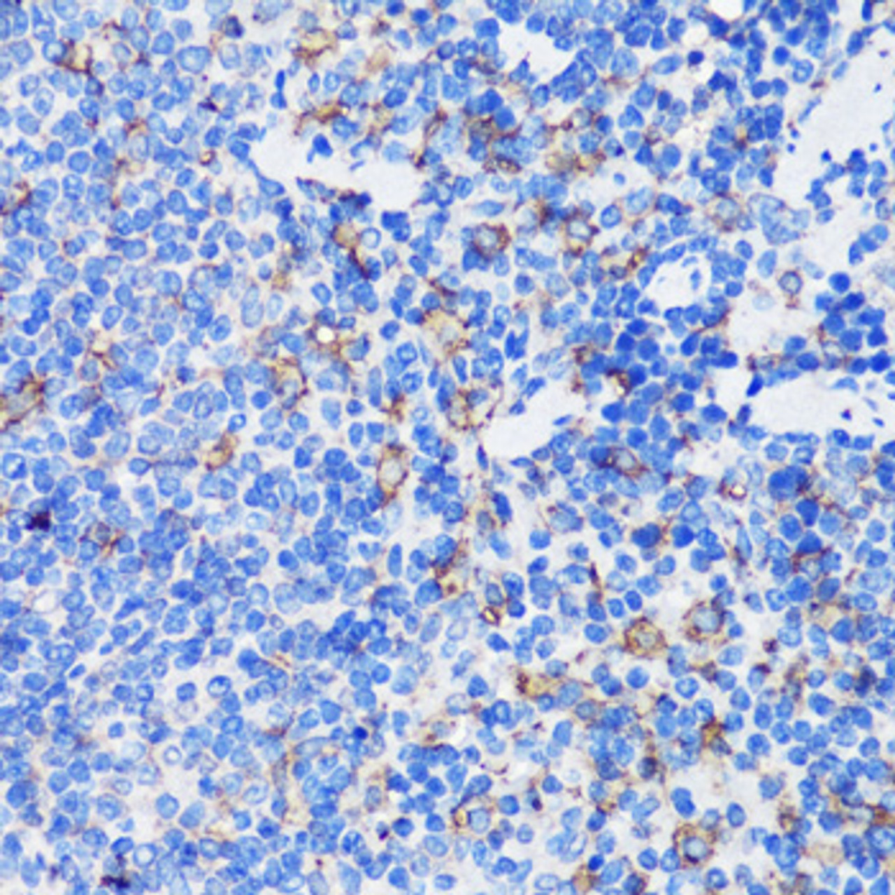 Immunohistochemistry of paraffin-embedded mouse spleen using MPO antibody (15-177) at dilution of 1:100 (40x lens) .