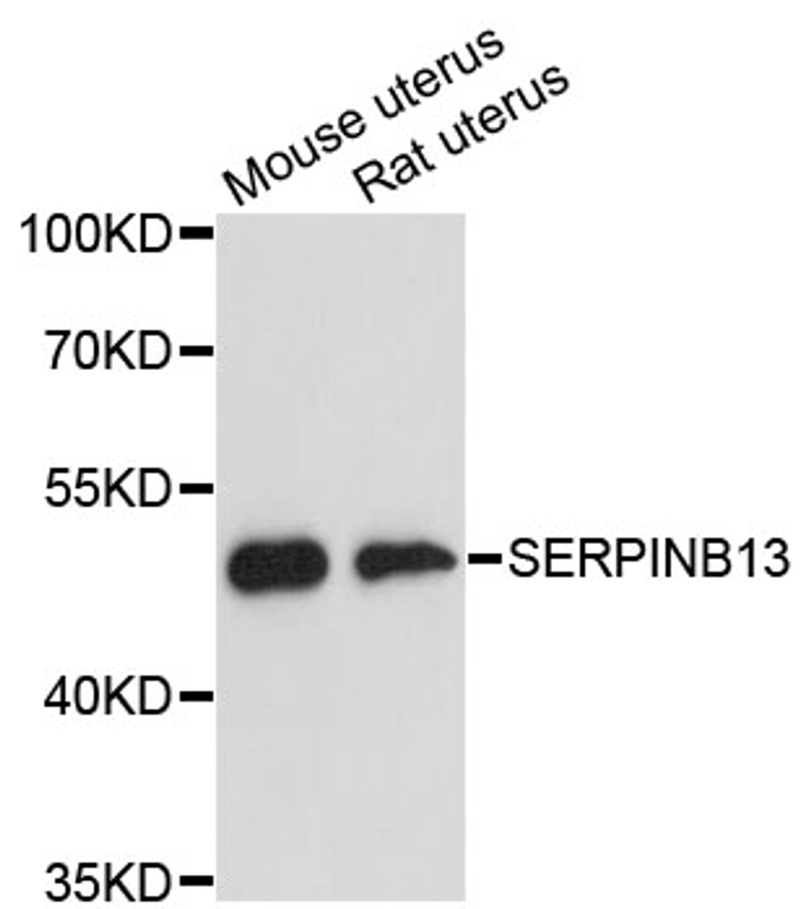 Western blot analysis of extracts of various cell lines, using SERPINB13 antibody (15-181) at 1:3000 dilution.<br/>Secondary antibody: HRP Goat Anti-Rabbit IgG (H+L) at 1:10000 dilution.<br/>Lysates/proteins: 25ug per lane.<br/>Blocking buffer: 3% nonfat dry milk in TBST.<br/>Detection: ECL Basic Kit.<br/>Exposure time: 90s.