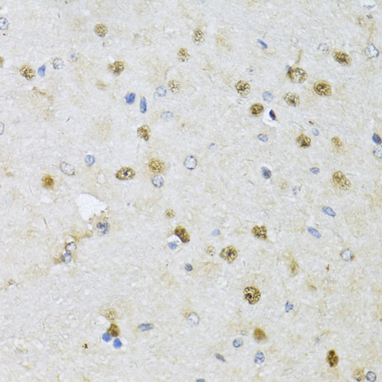 Immunohistochemistry of paraffin-embedded rat brain using CMAS antibody (15-184) at dilution of 1:150 (40x lens) .
