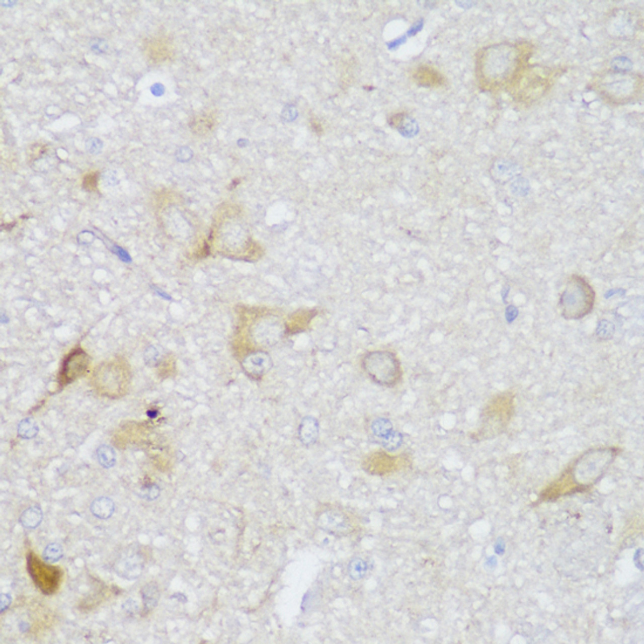 Immunohistochemistry of paraffin-embedded rat brain using EDC3 antibody (15-190) at dilution of 1:150 (40x lens) .