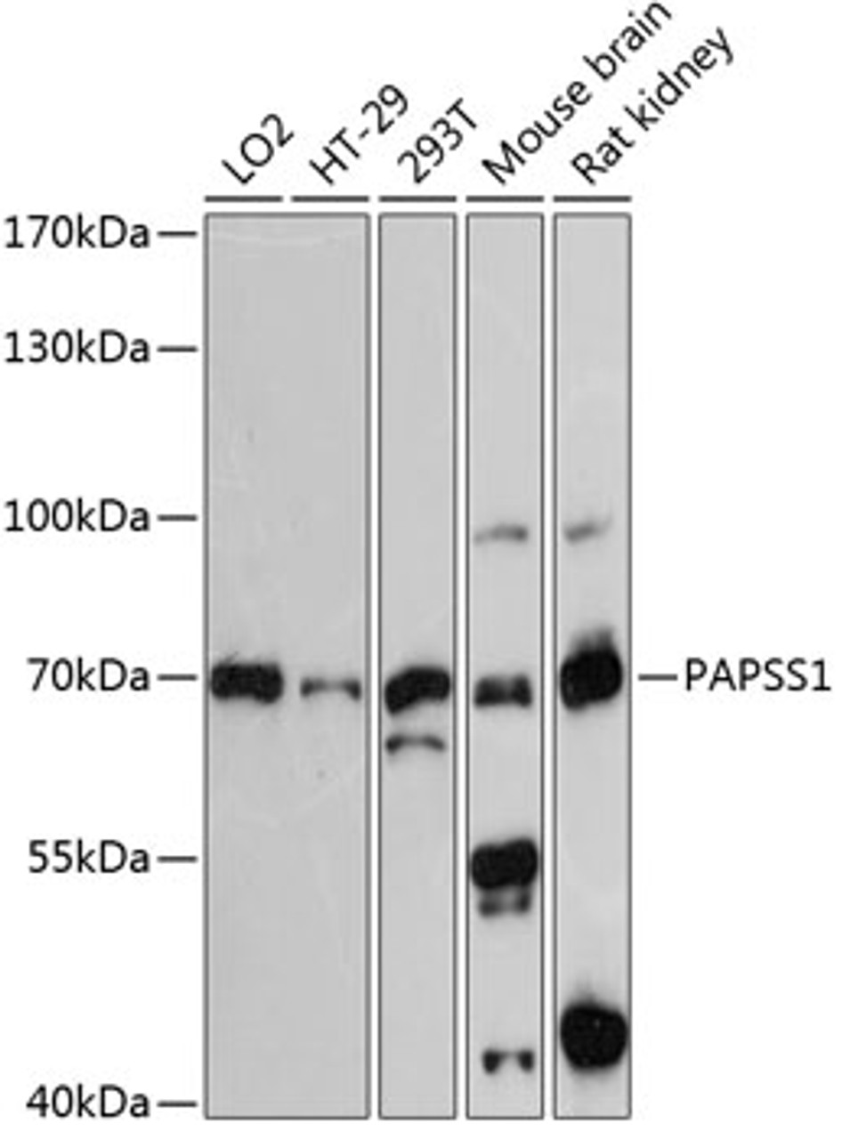 Western blot analysis of extracts of various cell lines, using PAPSS1 antibody (15-195) at 1:3000 dilution.<br/>Secondary antibody: HRP Goat Anti-Rabbit IgG (H+L) at 1:10000 dilution.<br/>Lysates/proteins: 25ug per lane.<br/>Blocking buffer: 3% nonfat dry milk in TBST.<br/>Detection: ECL Basic Kit.<br/>Exposure time: 90s.