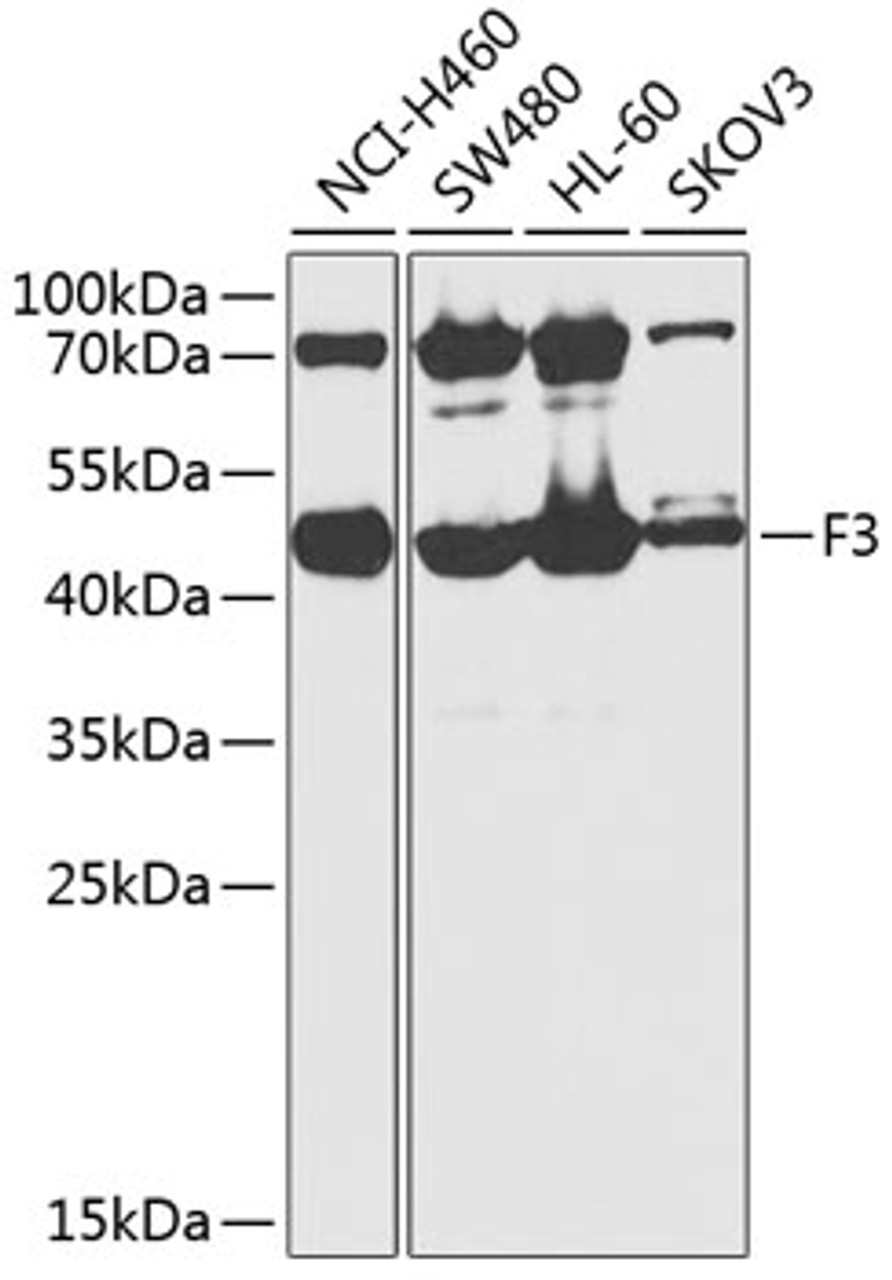 Western blot analysis of extracts of various cell lines, using F3 antibody (15-199) at 1:1000 dilution.<br/>Secondary antibody: HRP Goat Anti-Rabbit IgG (H+L) at 1:10000 dilution.<br/>Lysates/proteins: 25ug per lane.<br/>Blocking buffer: 3% nonfat dry milk in TBST.<br/>Detection: ECL Basic Kit.<br/>Exposure time: 10s.