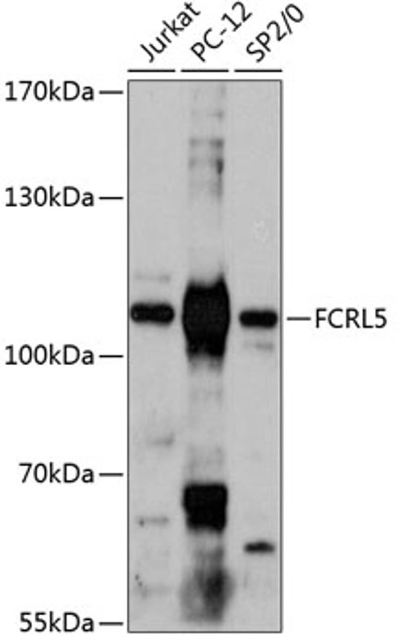 Western blot analysis of extracts of various cell lines, using FCRL5 antibody (15-209) at 1:3000 dilution.<br/>Secondary antibody: HRP Goat Anti-Rabbit IgG (H+L) at 1:10000 dilution.<br/>Lysates/proteins: 25ug per lane.<br/>Blocking buffer: 3% nonfat dry milk in TBST.<br/>Detection: ECL Basic Kit.<br/>Exposure time: 90s.