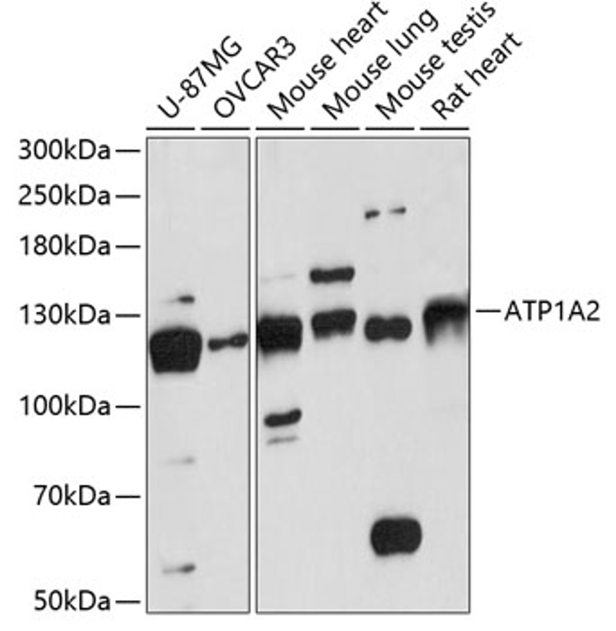 Western blot analysis of extracts of various cell lines, using ATP1A2 antibody (15-211) at 1:3000 dilution.<br/>Secondary antibody: HRP Goat Anti-Rabbit IgG (H+L) at 1:10000 dilution.<br/>Lysates/proteins: 25ug per lane.<br/>Blocking buffer: 3% nonfat dry milk in TBST.<br/>Detection: ECL Basic Kit.<br/>Exposure time: 90s.