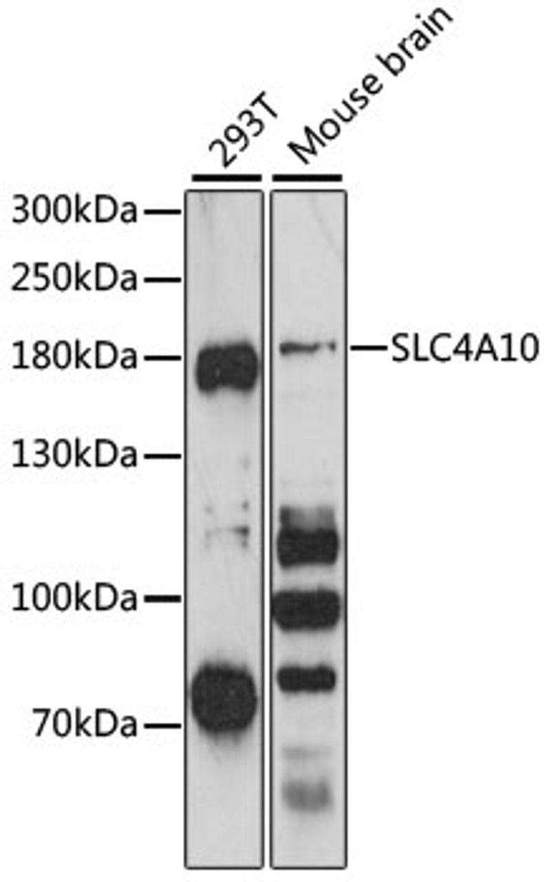 Western blot analysis of extracts of various cell lines, using SLC4A10 antibody (15-213) at 1:3000 dilution.<br/>Secondary antibody: HRP Goat Anti-Rabbit IgG (H+L) at 1:10000 dilution.<br/>Lysates/proteins: 25ug per lane.<br/>Blocking buffer: 3% nonfat dry milk in TBST.<br/>Detection: ECL Basic Kit.<br/>Exposure time: 90s.