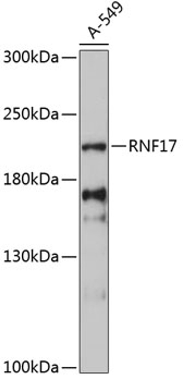 Western blot analysis of extracts of A-549 cells, using RNF17 antibody (15-214) at 1:3000 dilution.<br/>Secondary antibody: HRP Goat Anti-Rabbit IgG (H+L) at 1:10000 dilution.<br/>Lysates/proteins: 25ug per lane.<br/>Blocking buffer: 3% nonfat dry milk in TBST.<br/>Detection: ECL Enhanced Kit.<br/>Exposure time: 90s.
