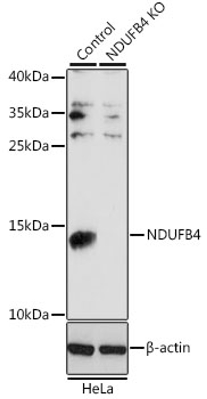 Western blot analysis of extracts from normal (control) and NDUFB4 knockout (KO) HeLa cells, using NDUFB4 antibody (15-218) at 1:1000 dilution.<br/>Secondary antibody: HRP Goat Anti-Rabbit IgG (H+L) at 1:10000 dilution.<br/>Lysates/proteins: 25ug per lane.<br/>Blocking buffer: 3% nonfat dry milk in TBST.<br/>Detection: ECL Basic Kit.<br/>Exposure time: 30s.