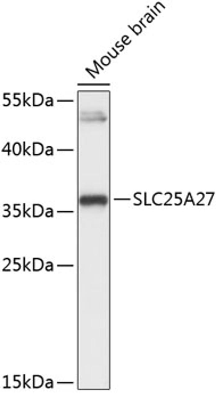 Western blot analysis of extracts of mouse brain, using SLC25A27 Antibody (15-224) at 1:3000 dilution.<br/>Secondary antibody: HRP Goat Anti-Rabbit IgG (H+L) at 1:10000 dilution.<br/>Lysates/proteins: 25ug per lane.<br/>Blocking buffer: 3% nonfat dry milk in TBST.<br/>Detection: ECL Basic Kit.<br/>Exposure time: 30s.