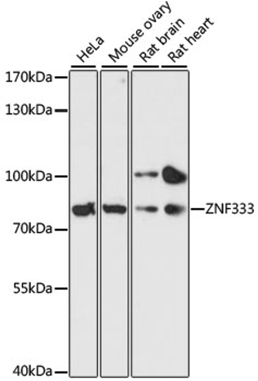 Western blot analysis of extracts of various cell lines, using ZNF333 antibody (15-231) at 1:3000 dilution.<br/>Secondary antibody: HRP Goat Anti-Rabbit IgG (H+L) at 1:10000 dilution.<br/>Lysates/proteins: 25ug per lane.<br/>Blocking buffer: 3% nonfat dry milk in TBST.<br/>Detection: ECL Basic Kit.<br/>Exposure time: 90s.