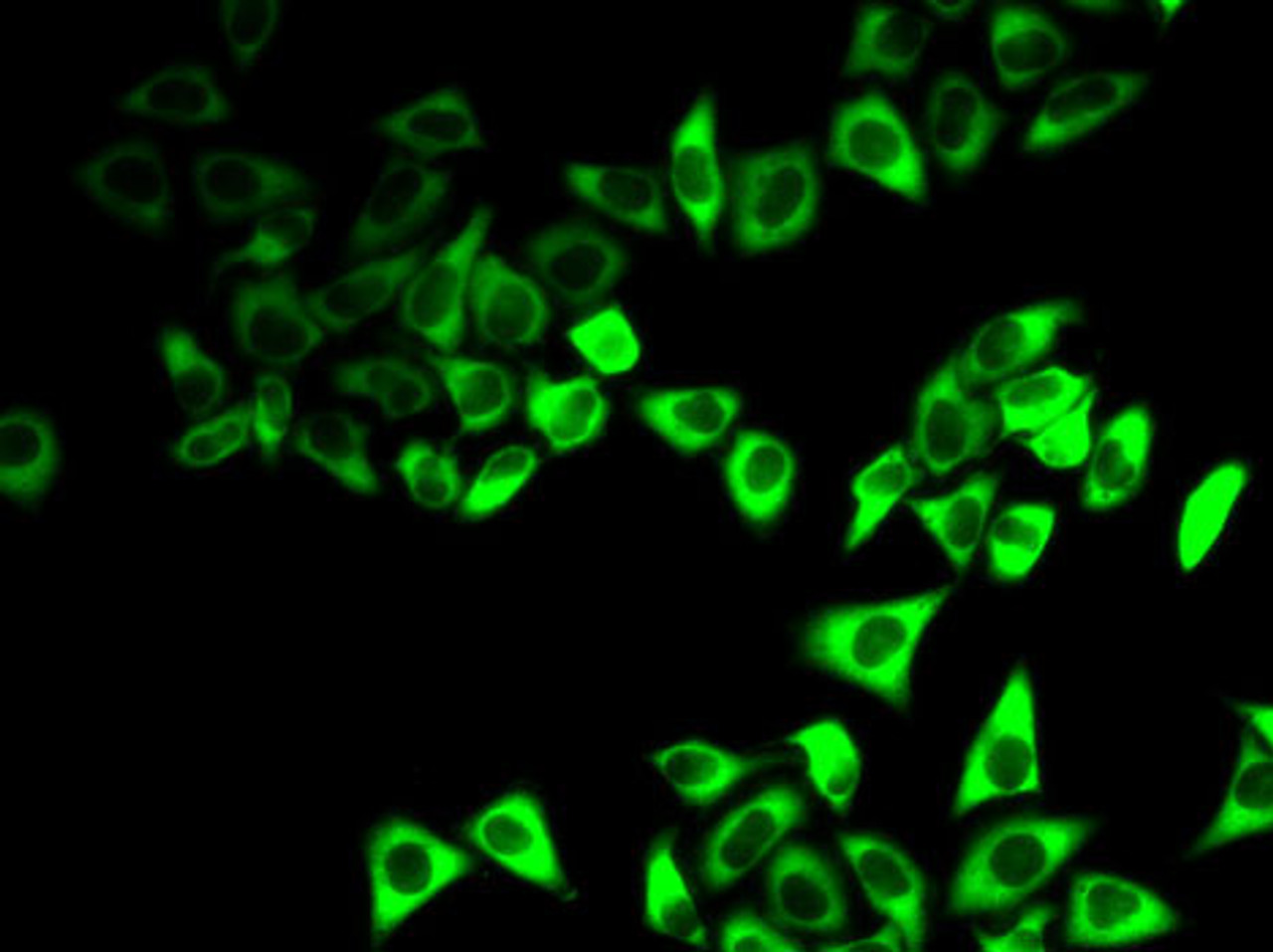 Immunofluorescence analysis of HeLa cells using IGFBP5 antibody (15-235) .