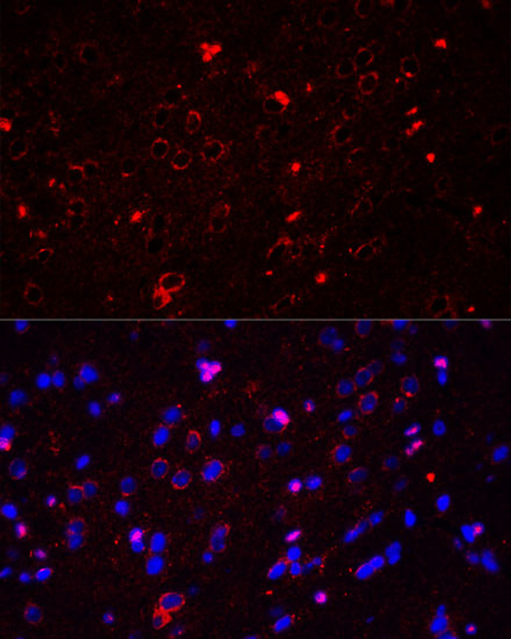 Immunofluorescence analysis of rat brain using GRIN2A antibody (15-236) at dilution of 1:50. Blue: DAPI for nuclear staining.