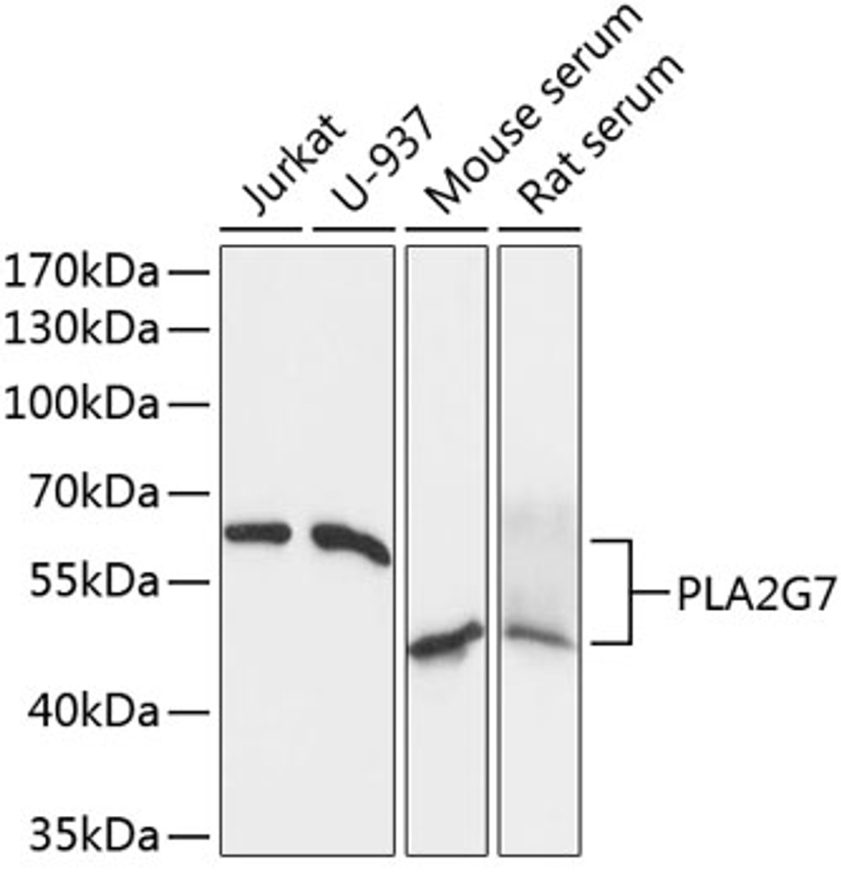 Western blot analysis of extracts of various cell lines, using PLA2G7 Antibody (15-237) at 1:1000 dilution.<br/>Secondary antibody: HRP Goat Anti-Rabbit IgG (H+L) at 1:10000 dilution.<br/>Lysates/proteins: 25ug per lane.<br/>Blocking buffer: 3% nonfat dry milk in TBST.<br/>Detection: ECL Basic Kit.<br/>Exposure time: 3s.