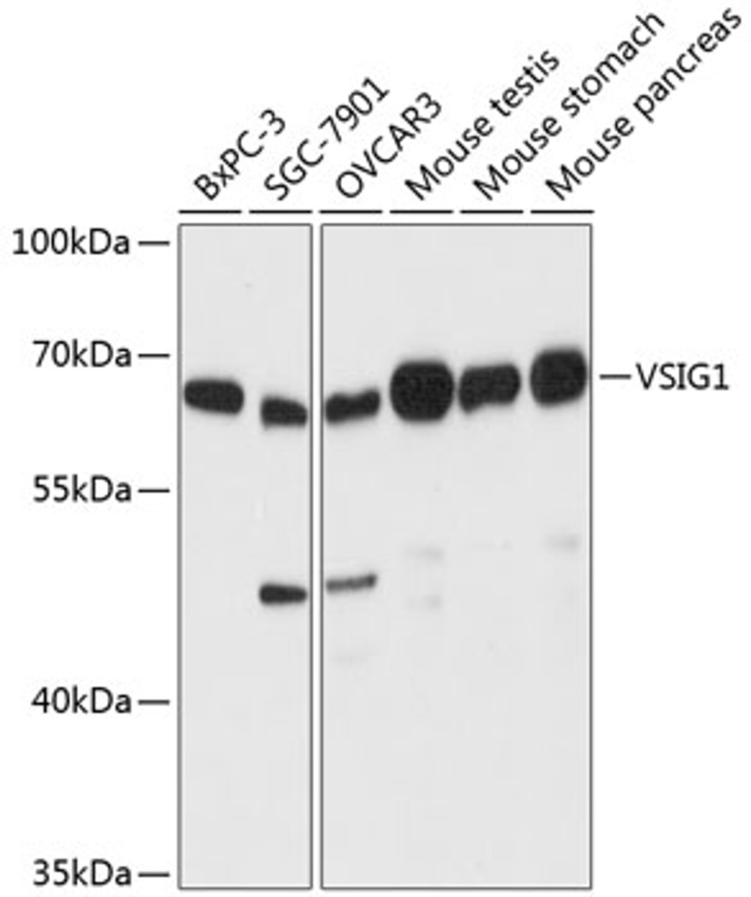 Western blot analysis of extracts of various cell lines, using VSIG1 antibody (15-245) at 1:3000 dilution.<br/>Secondary antibody: HRP Goat Anti-Rabbit IgG (H+L) at 1:10000 dilution.<br/>Lysates/proteins: 25ug per lane.<br/>Blocking buffer: 3% nonfat dry milk in TBST.<br/>Detection: ECL Basic Kit.<br/>Exposure time: 90s.